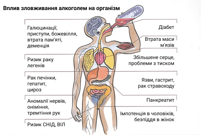 ЛІКУВАННЯ АЛКОГОЛІЗМУ В ХАРКОВІ