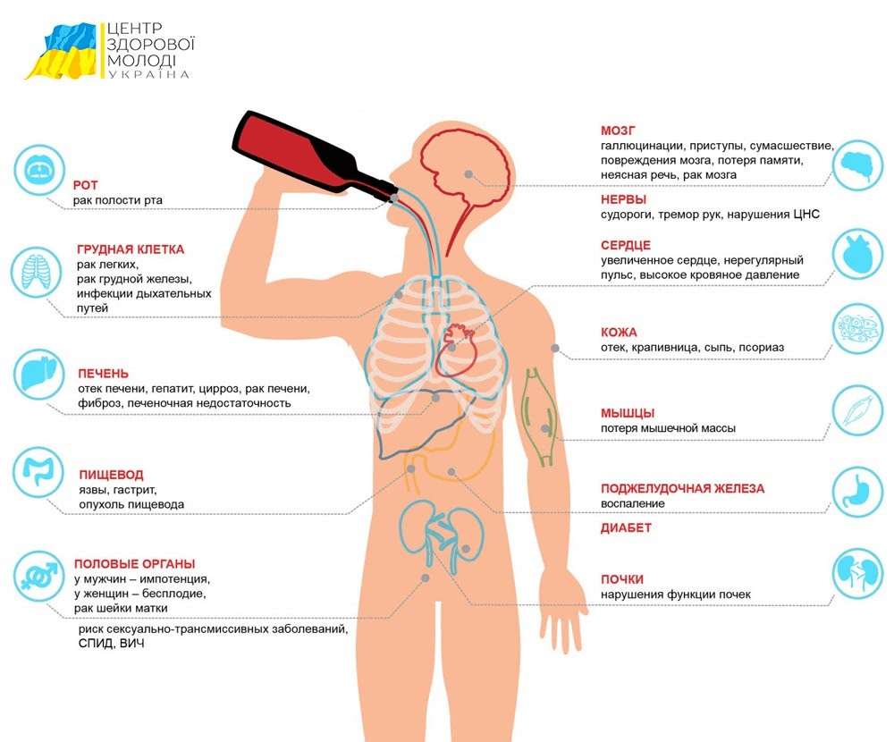 Лікування алкоголізму Лікування алкоголізму - image 15 1