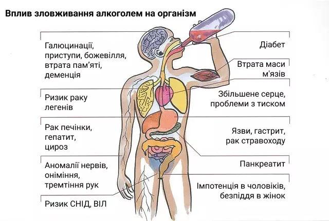 лікування алкоголізму